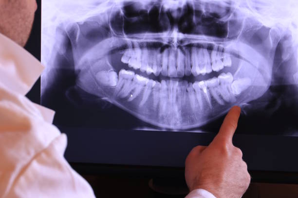 Best Emergency Treatment for Dental Infections or Abscesses in Gretna, VA